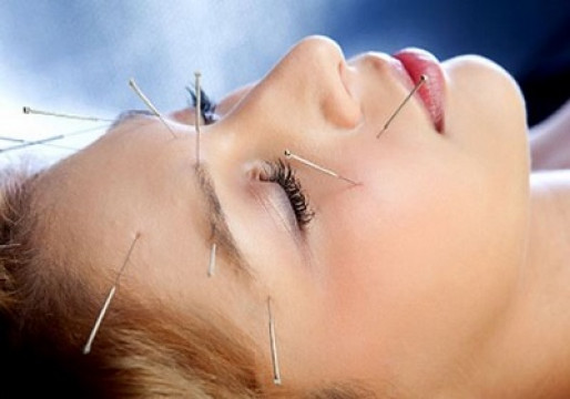 Acupunctură Buzău