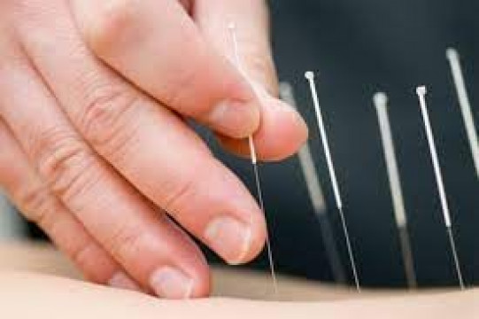 Acupunctura Sibiu